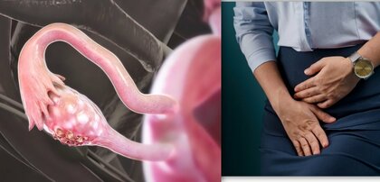 【出産減で生理回数10倍に】“多すぎる生理”で「卵巣がん」増加　「低用量ピル」で予防可能！