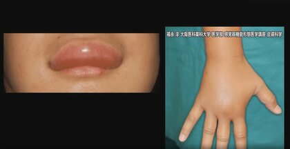 希少疾患の“未診断”をゼロに 医師と企業が連携するコンソーシアム誕生…メリットと成功のカギは