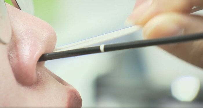 薬液を綿棒で炎症個所に塗る