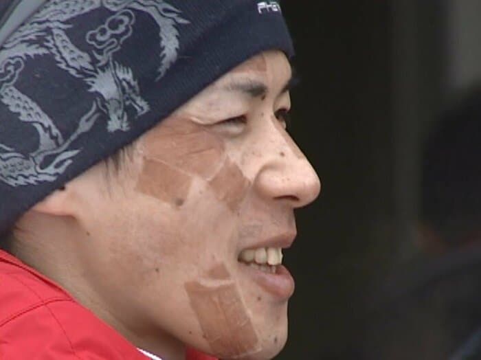 事故後始めて大倉山に足を運んだ金子選手