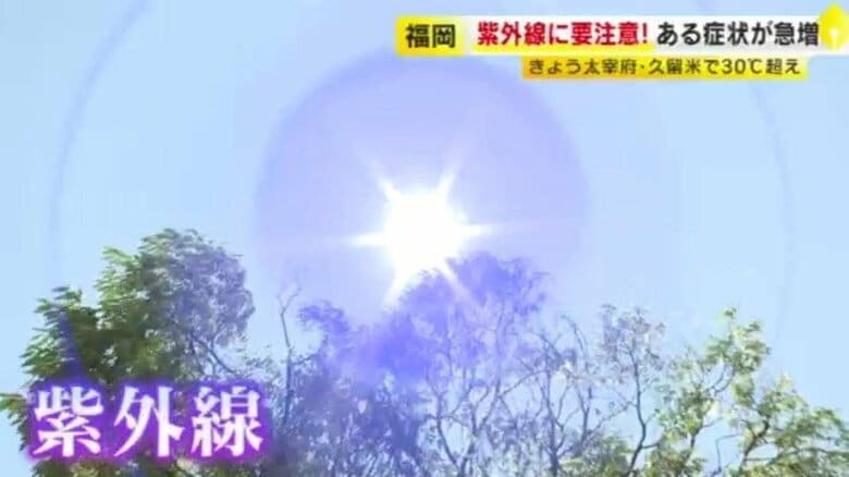 忍び寄る夏の脅威「目の日焼け」 専門家が警鐘　サングラスだけではない…あなたの瞳を守る最新UV対策【福岡発】｜FNNプライムオンライン