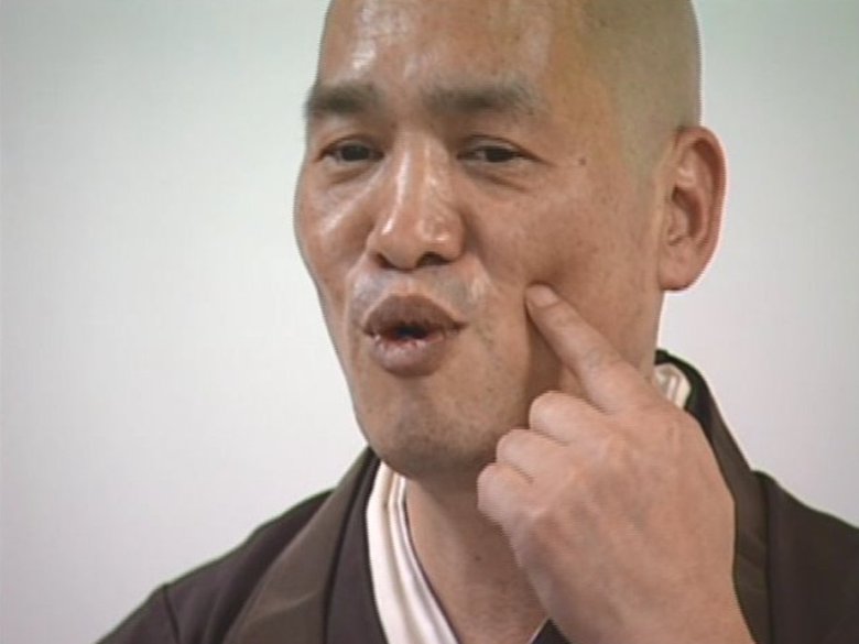 金子さんは左側のあごの一部を切除したという