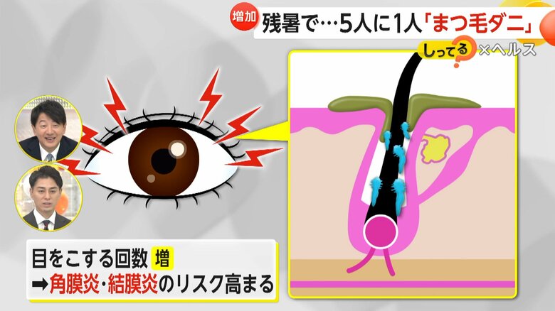 まつ毛ダニの原因とリスク