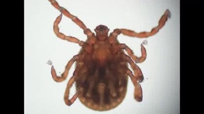 散歩中にマダニに噛まれたか　飼い犬がSFTS感染、犬の感染は富山県内で今年初確認　元気なく食欲低下