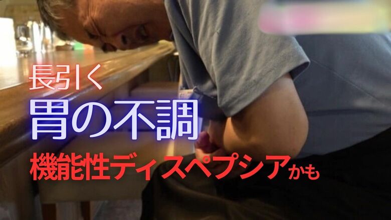 胃カメラで異常ないのに…“もたれ”や痛み　ストレスフルの現代では国民病「機能性ディスペプシア」　対処のポイントは“完璧を求めすぎない”｜FNNプライムオンライン