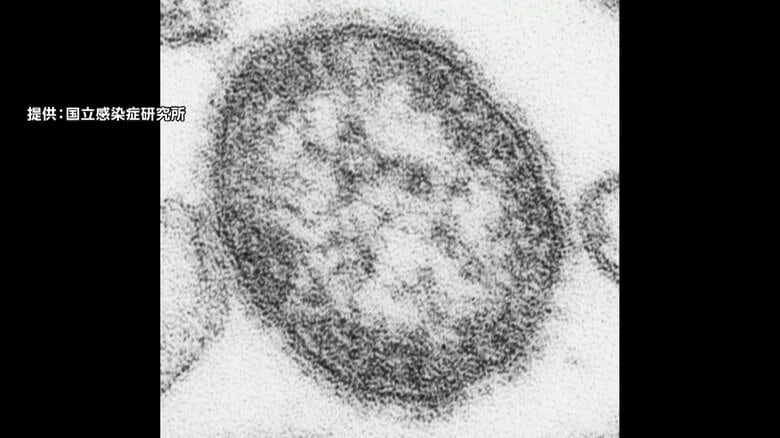 “はしか”は39度以上の高熱・全身の発疹・せきや鼻水などの症状の他、肺炎や中耳炎を合併しやすく、患者1000人に1人の割合で脳炎が発症