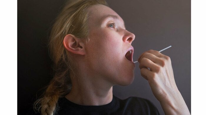 唾液や、頬の内側の細胞を綿棒などでこすり取って送るのが一般的
