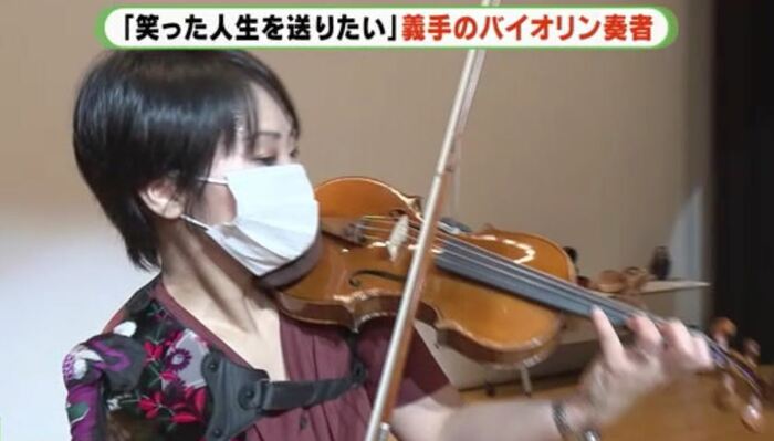 伊藤さん「義手は隠すものではない。かっこいい存在になれば」