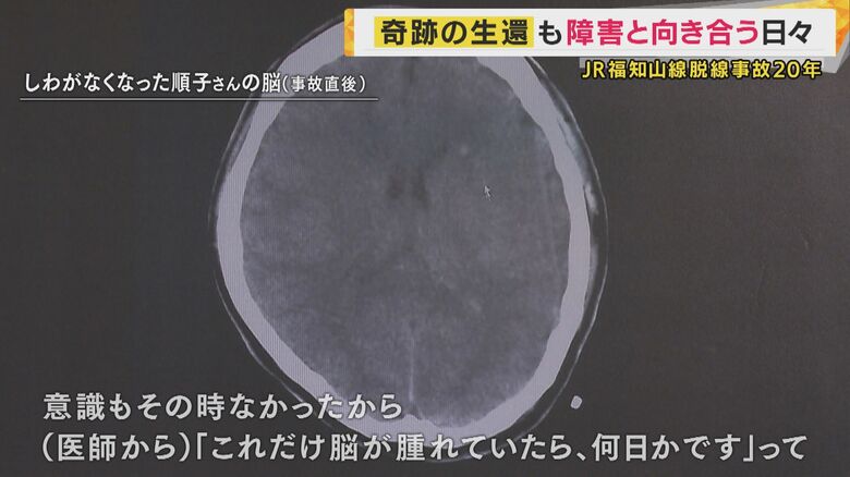 脳にも大きな損傷があった