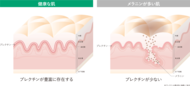 根強いシミにつながる皮膚内部の構造的特徴を発見