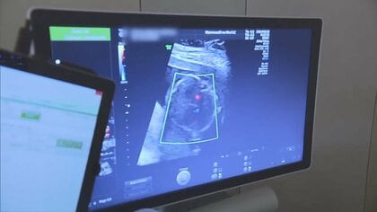 9カ所医療機関に断られ…自宅で早産の赤ちゃん死亡 コロナ感染妊婦の受け入れに課題