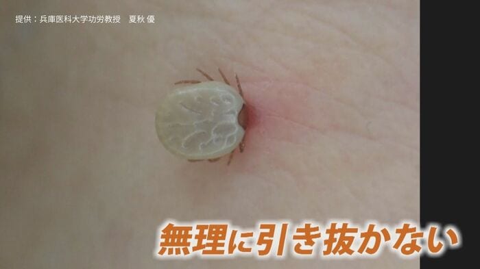 提供：兵庫医科大学功労教授　夏秋優