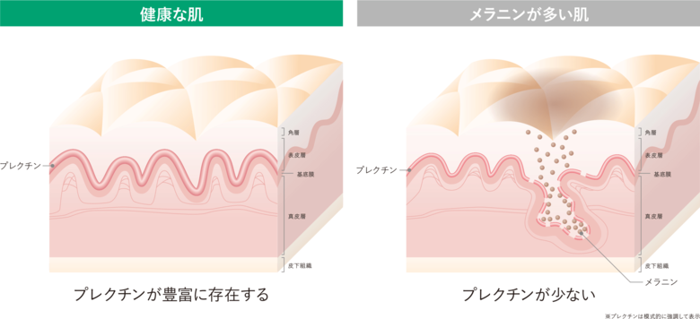 根強いシミにつながる皮膚内部の構造的特徴を発見