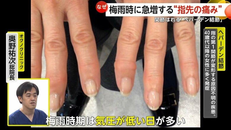 国内では約300万人の人が悩まされているという