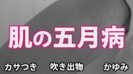 肌も五月病になる！？　新生活のストレスが引き起こす肌トラブル　適切なケアと“汗活”で夏への備えを　