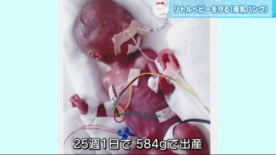 赤ちゃんの命救う 母乳バンク 1500グラム未満の赤ちゃんに 粉ミルクはリスク となる場合も 広島発