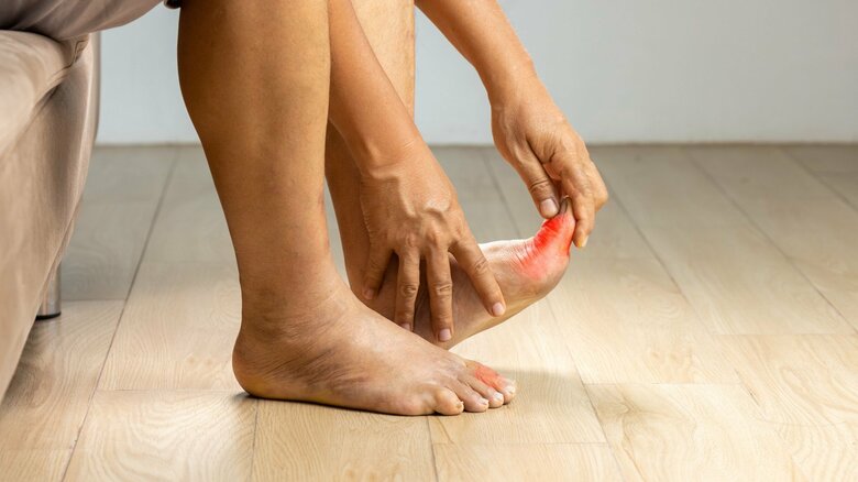 痛風の発症リスクが減っていたという（画像はイメージ）