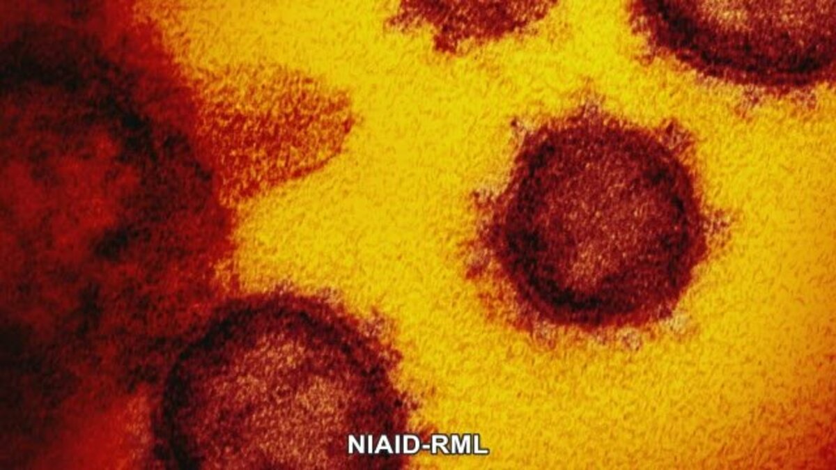 ワクチン接種状況 香川県の３回目接種率は４７ ３５ 年代別は 4 18現在 香川