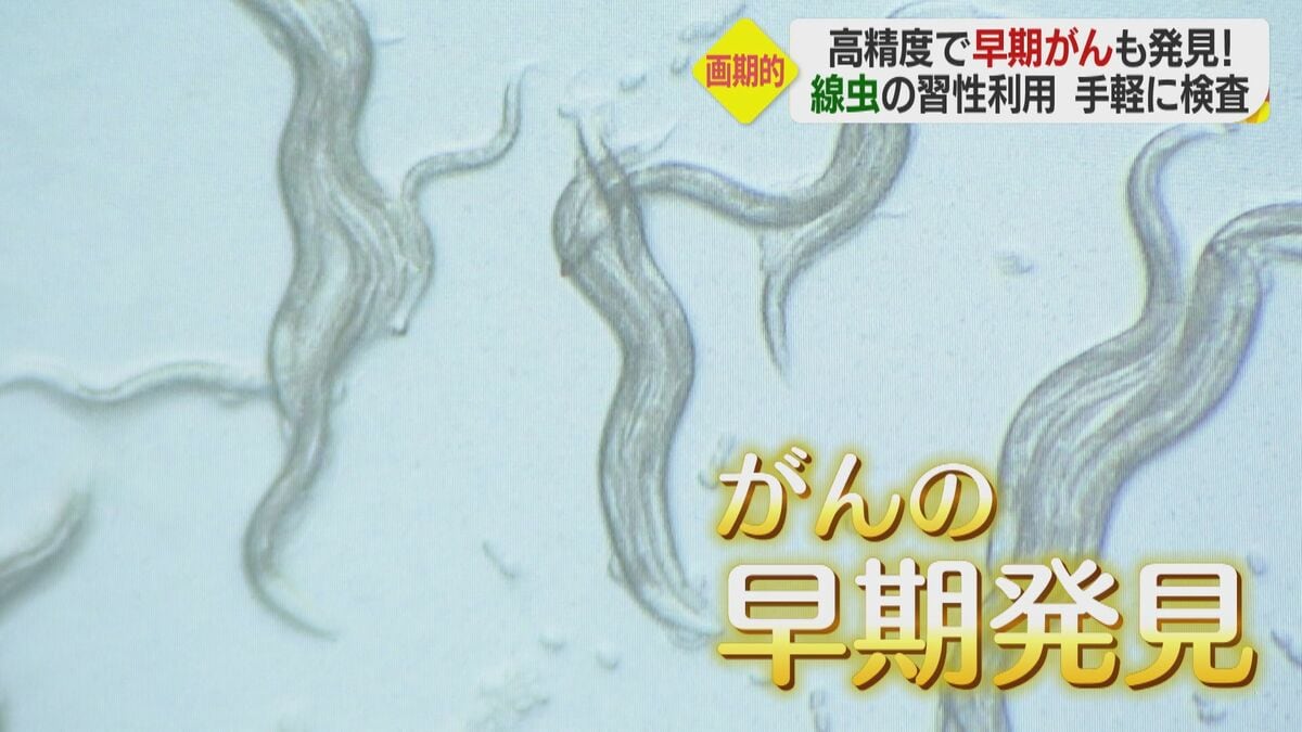線虫」が匂いかぎ分け…1滴の尿で15種類のがんリスクを86％判定 注目の