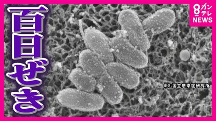 感染拡大する『百日ぜき』感染力はインフルエンザの約10倍　激しいせきで“あばら折れる”ことも　子供の重症化に要注意