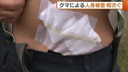 【クマ被害】60代男性が自宅敷地内で襲われ軽傷「人ごとだと思っていた」 温泉街では宿泊客の30代男性が襲われる…観光への影響懸念も 新潟