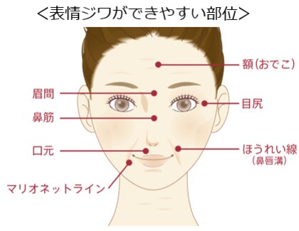 <4月8日はシワの日>知らず“老け見え”しているかも?自分では気づきにくい“表情ジワ”にご注意