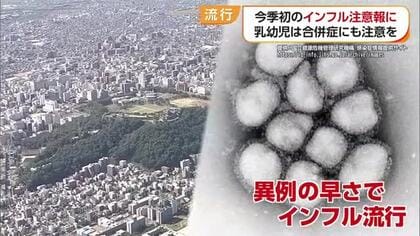 インフルエンザが愛媛県内で注意報レベルに　乳幼児はインフルエンザ脳症にも注意を【愛媛】