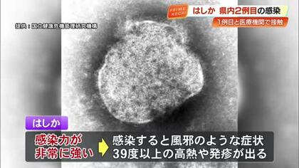 【高知】『はしか』県内2例目　1例目の患者と接触の30代医療従事者が感染