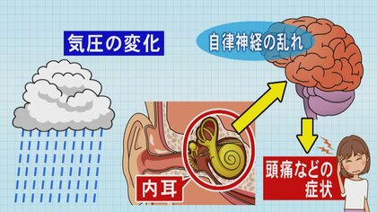 街には頭痛や倦怠感など訴える人が…『梅雨だる』の症状はなぜ起こるのか 医師が訴える“睡眠”の大切さ