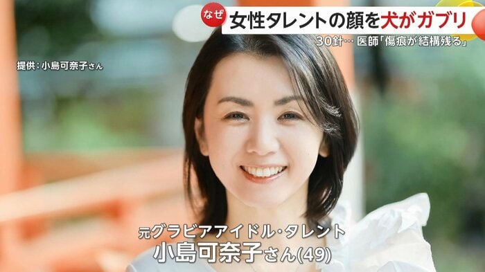 元グラビアアイドルでタレントの小島可奈子さん(49)