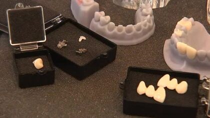 デジタル技術の歯科技工施設 盛岡市に開設　東北で初の機械を導入　岩手県