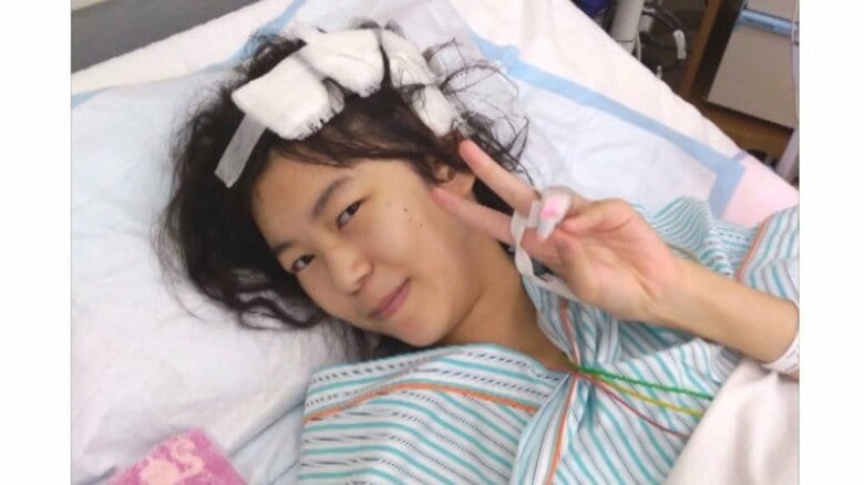 小学6年で「余命1年」と宣告…脳腫瘍と闘いながら漫画家を目指した少女の一生が映画に 両親がつなぐ“18年の証し”｜FNNプライムオンライン