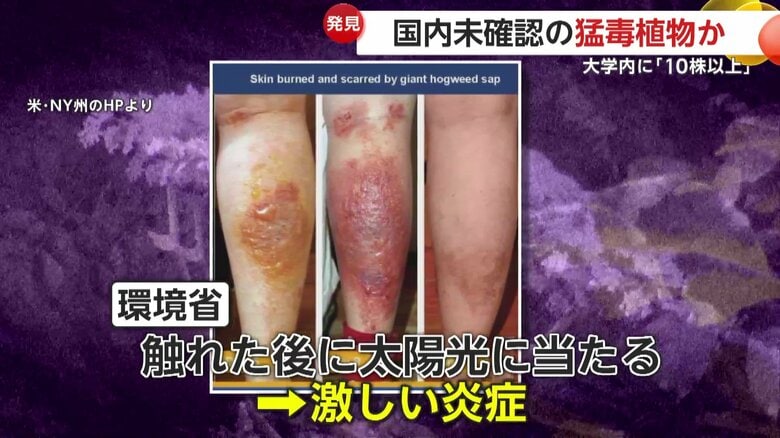 「前からあったと思う」北海道大学に国内未確認の猛毒ジャイアント・ホグウィード10株以上発見　周辺を立ち入り禁止に　札幌市｜FNNプライムオンライン