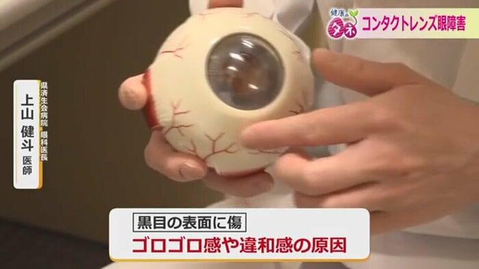 黒目の表面に傷が付くと違和感が…