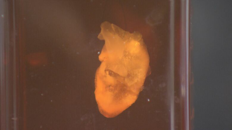 吊り下げることで強くなった拍動