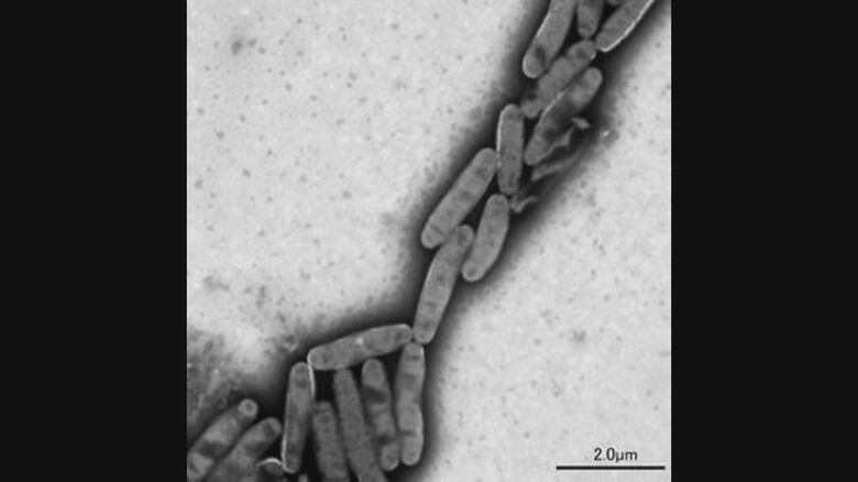 レジオネラ属菌　提供：さいたま市健康科学研究センター