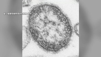 感染力強い「はしか」に集団感染…新宿区の飲食店で20代男性従業員9人　国内患者100人、前年同期比4倍以上に