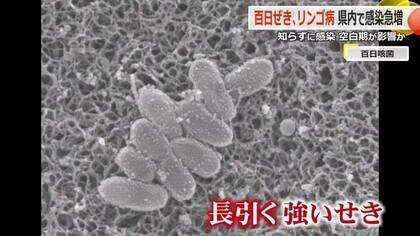 急増！百日咳とリンゴ病　“風邪のような初期症状”の段階で強い感染力　妊婦や血液の持病がある人は特に注意を【福井】