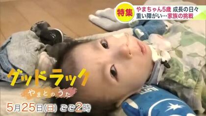 重い障がい“18トリソミー”医療的ケア児と家族の1年　「1歳まで生きることができるのは1割」チャレンジと成長の日々＿ドキュメンタリー『グッドラック　やまとのうた』5月25日放送　ナレーター泉谷星奈さん