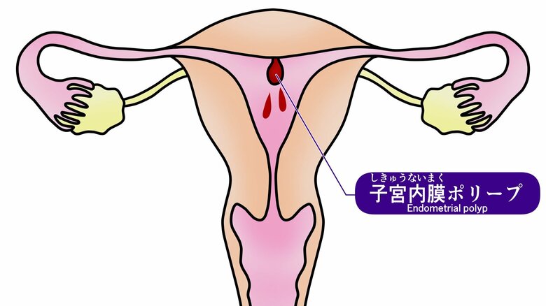 （画像はイメージ）