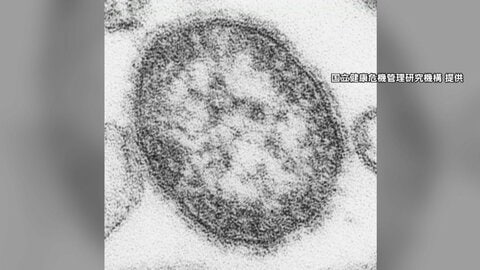 GW前にはしか感染者急増　362人は去年の4.4倍　小学校で集団感染から学年閉鎖に　都内では“ワクチン不足”も