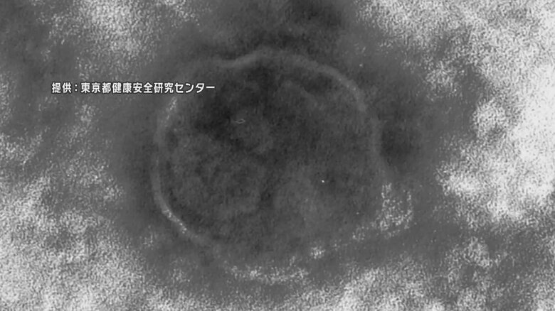 【はしかの感染相次ぐ】都内の5歳未満の男の子が感染　2月下旬に南アジアから帰国　都内での感染は3例目｜FNNプライムオンライン