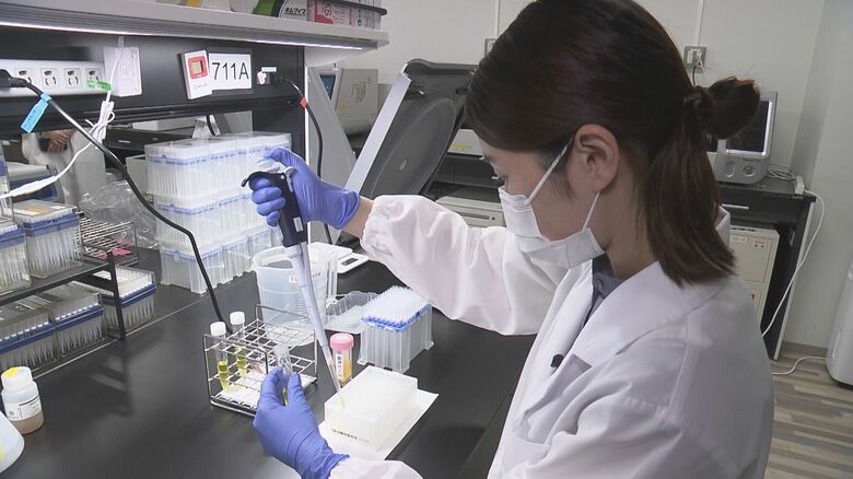 異常に気づかず死亡率高く…“沈黙の臓器”すい臓のガンを早期発見へ「尿」を使ったリスク診断も｜FNNプライムオンライン