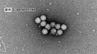 「感染性胃腸炎」「溶連菌」の患者が増加　溶連菌は前週の1.5倍　手洗いなど感染対策を呼びかけ　長野県　　