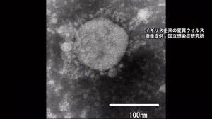 長野県内で「変異ウイルス」急拡大 過去最多の27人確認 累計65人 今月だけで57人