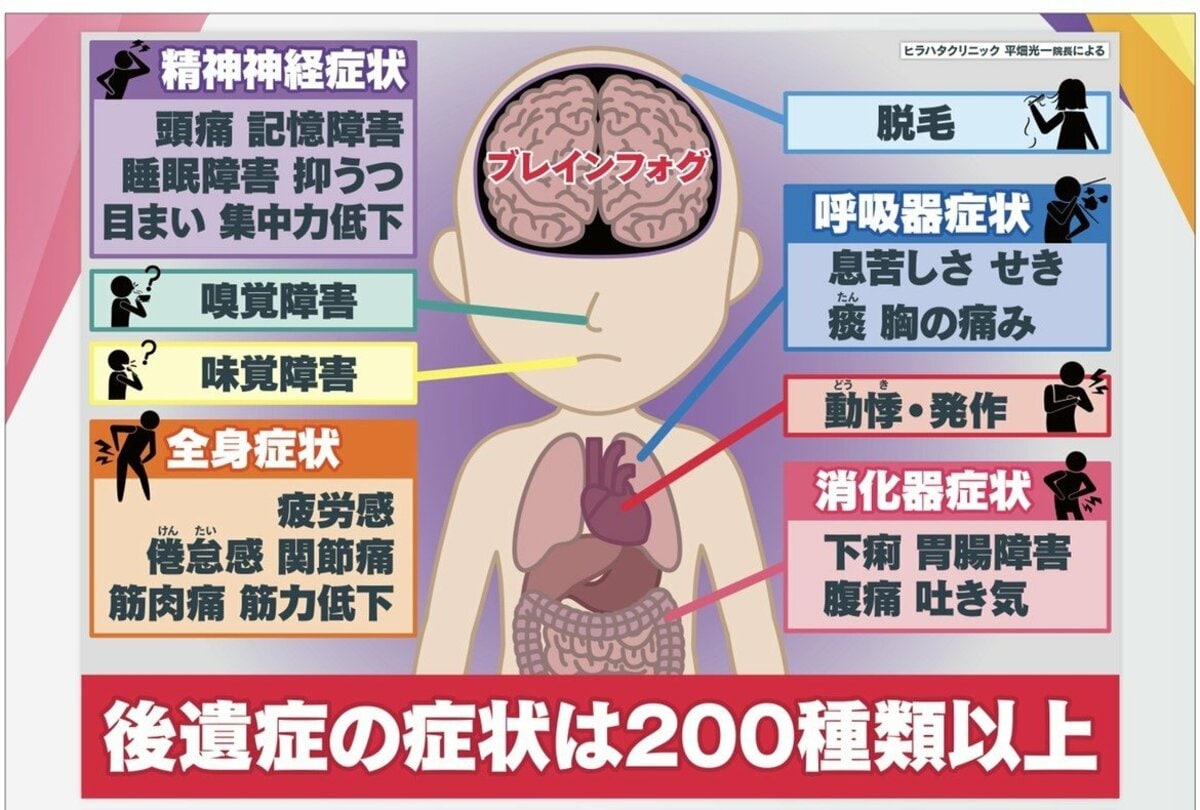 ブレインフォグ「脳に霧」 “コロナ後遺症” 感染1年後も頭痛や倦怠感 