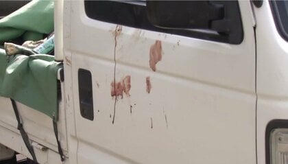 全身から出血『クマ』に襲われた男性　顔や両足を噛まれるも『自力』で下山　クマが男性に突進