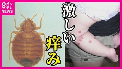 殺虫剤効かない「スーパートコジラミ」急増　猛烈なかゆみの原因　春は増殖する季節　「角、隅、隙間」をチェックして