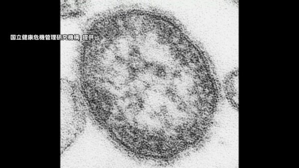 新宿区内の小学校ではしか集団発生　児童ら18人の感染確認　都内感染者は過去10年で最多180人に｜FNNプライムオンライン