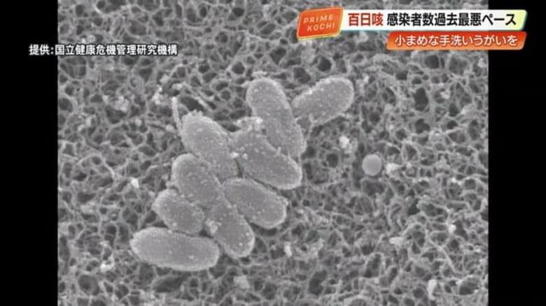 乳児の命を脅かす「百日咳」が高知県内で感染拡大、過去最多ペースで138人　予防接種を呼びかけ｜FNNプライムオンライン